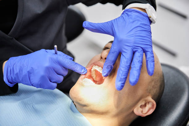 Best Urgent Tooth Repair  in Madisonville, TX